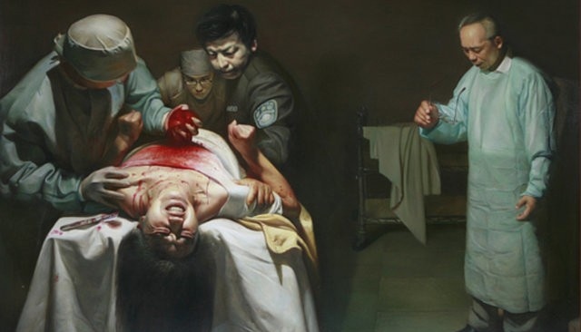 Tranh vẽ minh họa mổ cướp nội tạng tại Trung Quốc của tổ chức Falunart.org