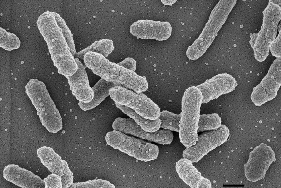 Hình ảnh vi khuẩn dịch hạch dưới kính hiển vi quang học.