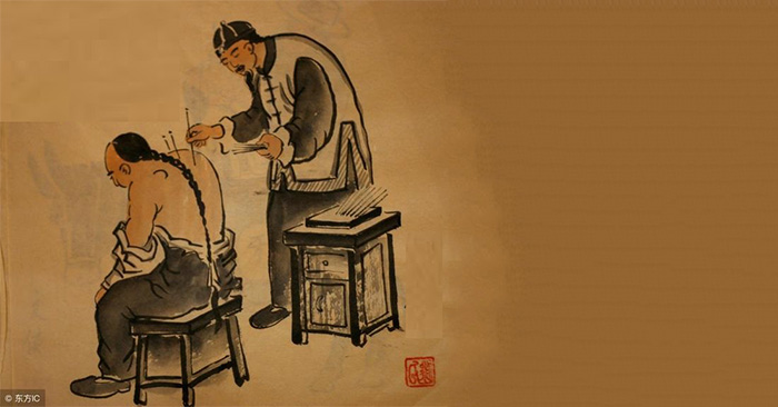 Châm cứu là một phương pháp điều trị y học cổ truyền của Trung Hoa đã được sử dụng trong hơn 2.000 năm