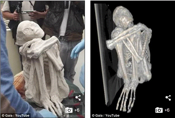 Ảnh chụp X - Quang cho thấy rõ chi tiết các khúc xương (ảnh: Vietnamplus).