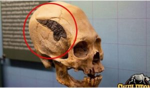 Giải mã dấu vết lạ trên hộp sọ chiến binh 2.000 năm tuổi 