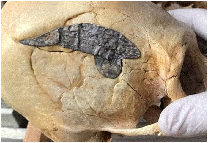 Giải mã dấu vết lạ trên hộp sọ chiến binh 2.000 năm tuổi 