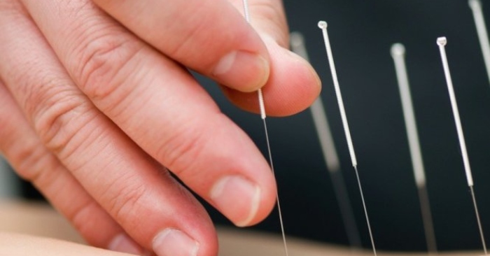 Châm cứu được đến từ đâu và khởi tác dụng trị bệnh như thế nào?
