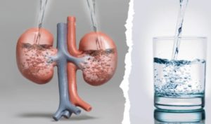 4 kiểu uống nước sai cách gây hại cho thận